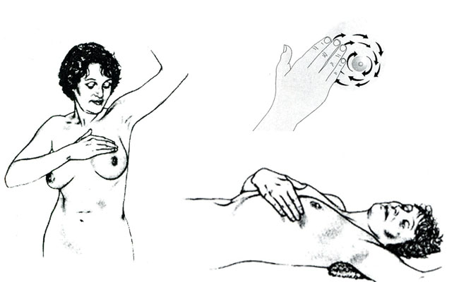 (solda) ayakta muayene, (sağ altta) yatarak muayene ve elle muayene 